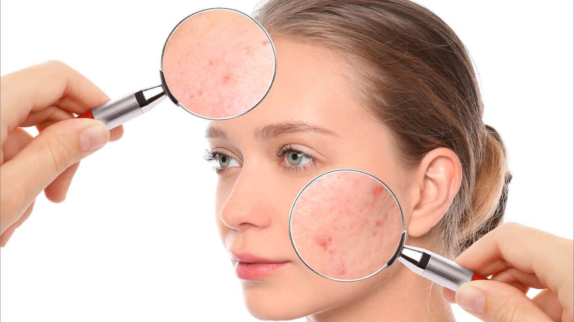 Eliminación de cicatrices