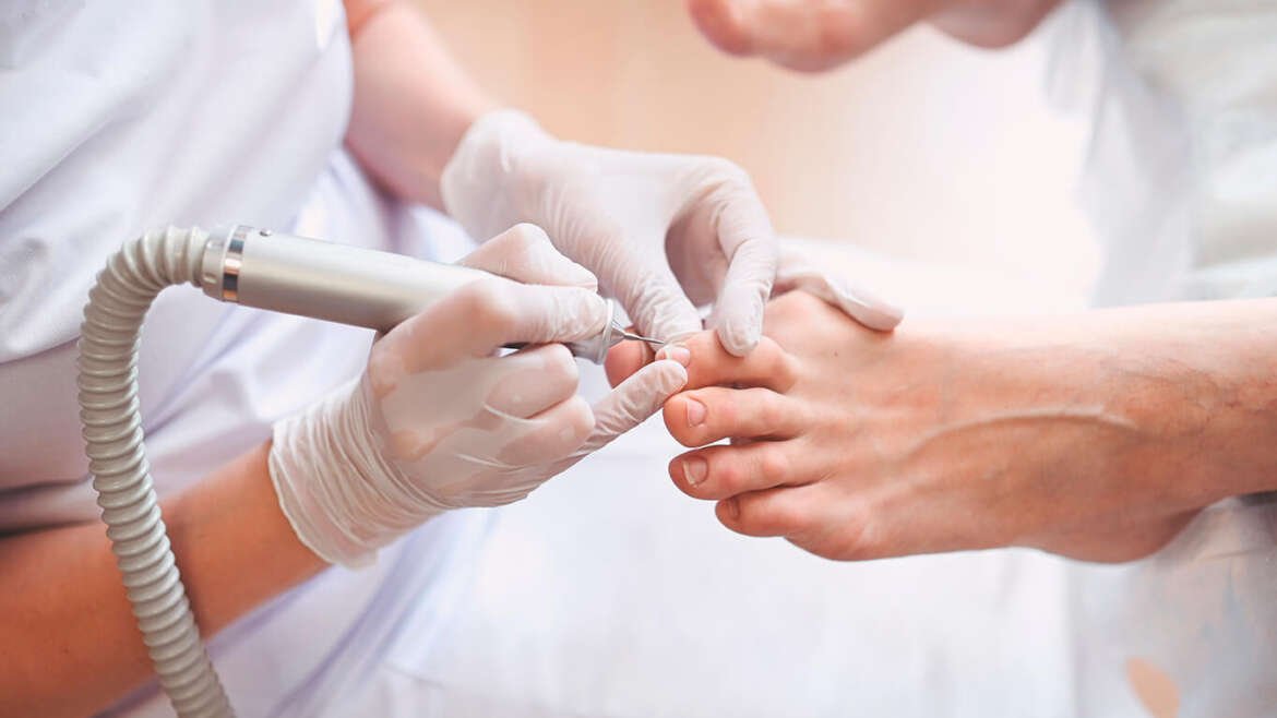 Tratamientos para uñas