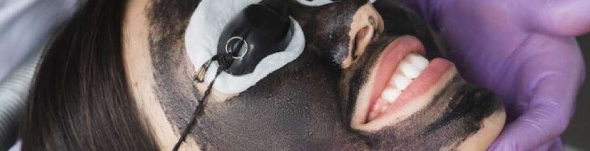 ¿Que es Hollywood Peel?